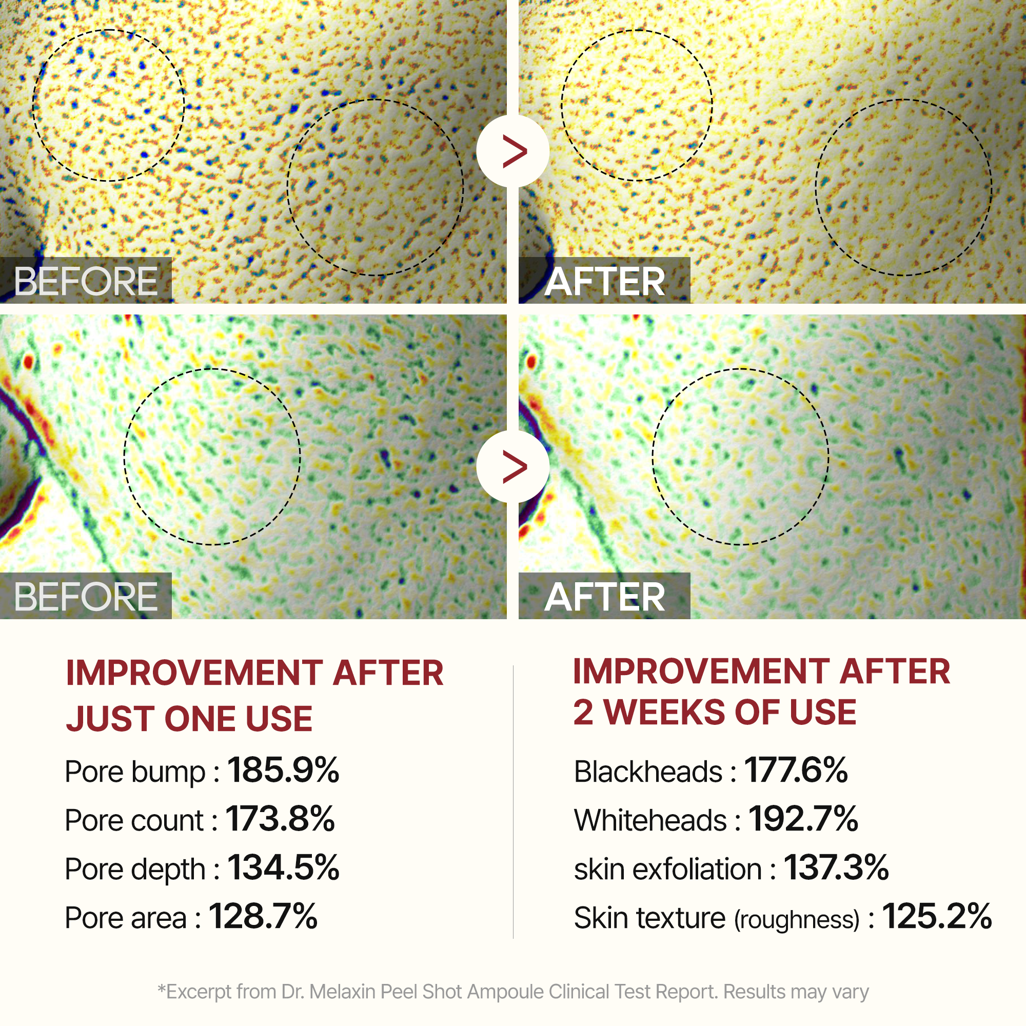 Peel Shot Glow Rice Line - Image 8