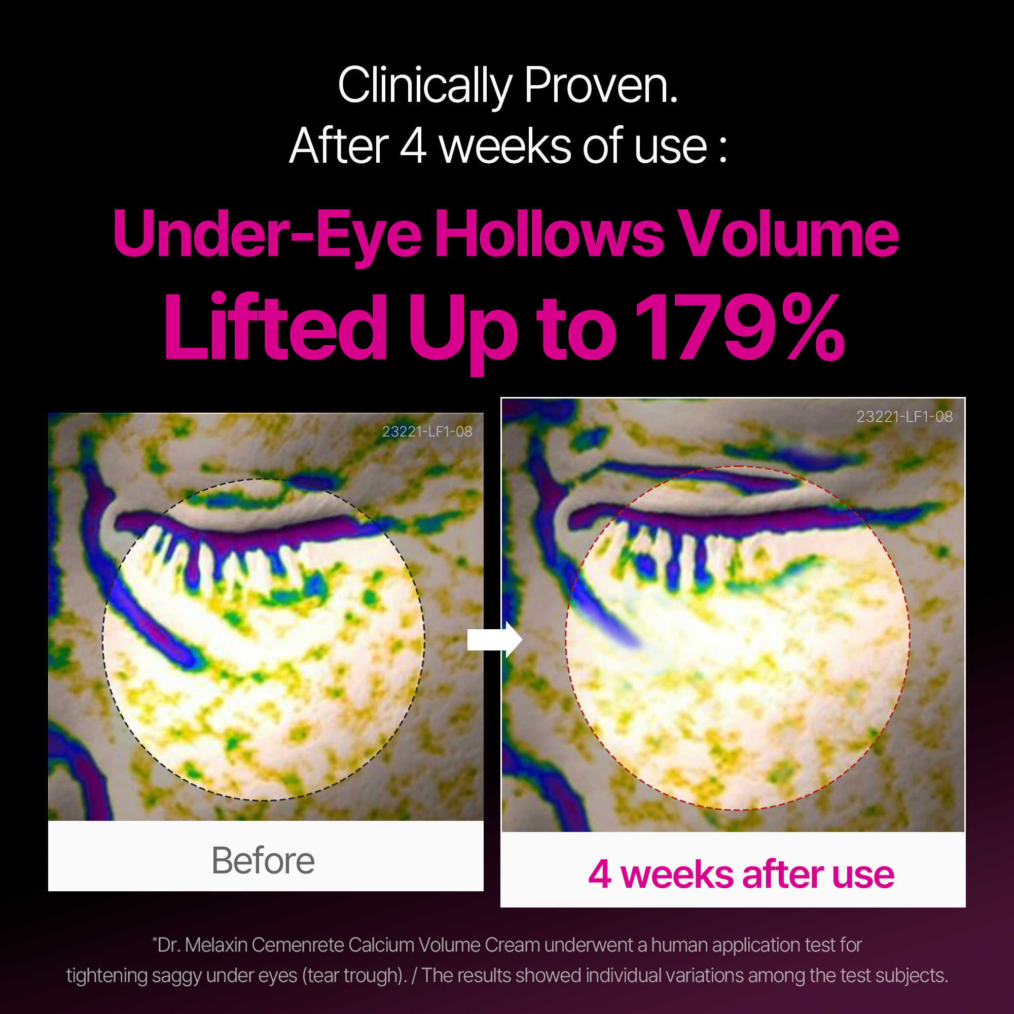 Cemenrete Calcium Intense Cream - Image 3